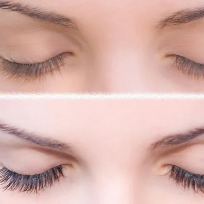سيروم تطويل وتكثيف الرموش لونك فور لاش Long4Lashes لتقوية الرموش 3 مل من Long4Lashes أصلي 100% | متوفر لدى صيدلية البحرين في الموصل بالعراق