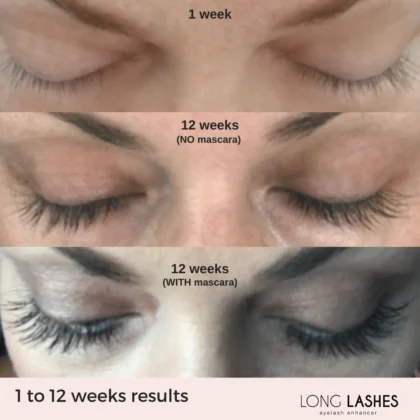 سيروم تطويل وتكثيف الرموش لونك فور لاش Long4Lashes لتقوية الرموش 3 مل من Long4Lashes أصلي 100% | متوفر لدى صيدلية البحرين في الموصل بالعراق